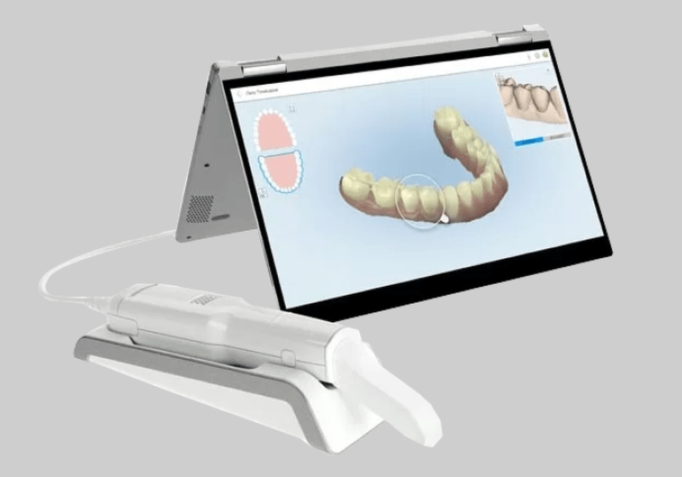Dental scanner displaying 3D tooth model on screen with intraoral scanner device below.